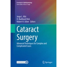 Alio, Cataract Surgery