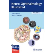 Biousse, Neuro-Ophthalmology Illustrated