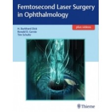 Dick, Femtosecond Laser Surgery in Ophthalmology