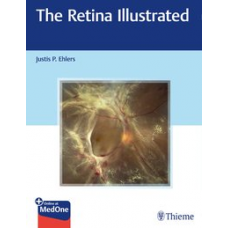 Ehlers, The Retina Illustrated