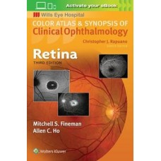 Fineman, Retina