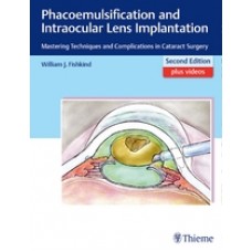 Fishkind, Phacoemulsification and Intraocular Lens Implantation