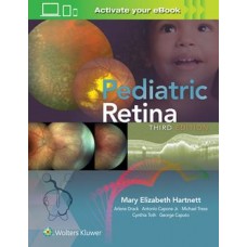 Hartnett, Pediatric Retina