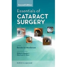 Henderson, Essentials of Cataract Surgery