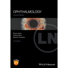 James, Lecture Notes: Ophthalmology