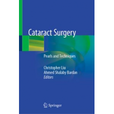 Liu, Cataract Surgery