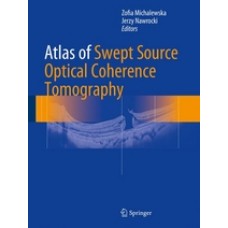 Michalewska, Atlas of Swept Source Optical Coherence Tomography