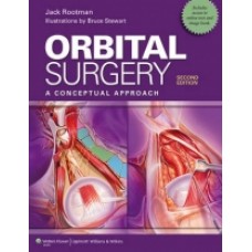 Rootman, Orbital Surgery