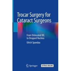 Spandau, Trocar Surgery for Cataract Surgeons
