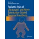Tsui, Pediatric Atlas of Ultrasound- and Nerve Stimulation Guided Regional Anesthesia