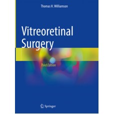 Williamson, Vitreoretinal Surgery