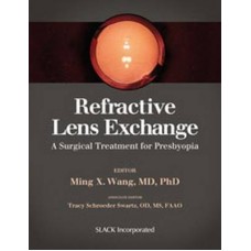 Wang, Refractive Lens Exchange