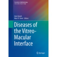 Girach, Diseases of the Vitreo-Macular Interface