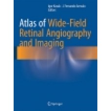 Kozak, Atlas of Wide-Field Retinal Angiography and Imaging