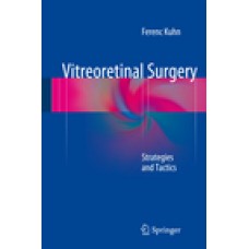 Kuhn, Vitreoretinal Surgery