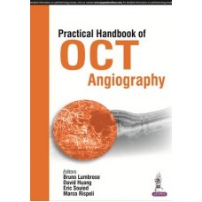 Lumbroso, Practical Handbook of OCT Angiography