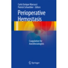 Marcucci, Perioperative Hemostasis