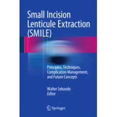 Sekundo, Small Incision Lenticule Extraction (SMILE)