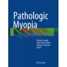 Spaide, Pathologic Myopia