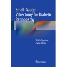 Spandau, Small-Gauge Vitrectomy for Diabetic Retinopathy