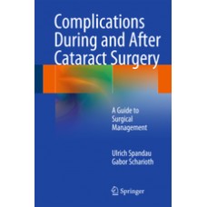 Spandau, Complications During and After Cataract Surgery