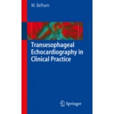 Belham, Transesophageal Echocardiography in Clinical Practice