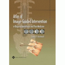 Rathmell, Atlas of Image-Guided Intervention in Pain Medicine