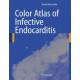 Ramsdale, Color Atlas of Infective Endocarditis